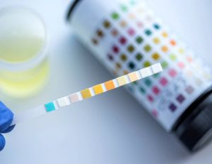 Santé : un test urinaire pour juger de la qualité de votre alimentation