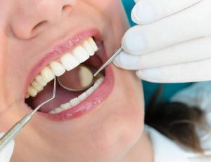 Soins dentaires : les Français ne vont pas assez chez le dentiste / iStock.com - oneblink-cj