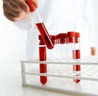 Dépistage de la trisomie 21 : un test sanguin arrive enfin / iStock.com - solidcolours