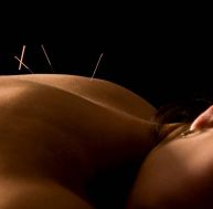 Médecine douce : tout savoir sur l’acupuncture / iStock.com - YanC