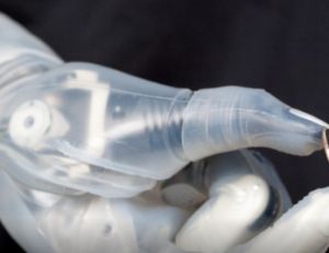 Le premier bras bionique commercialisé aux Etats-Unis
