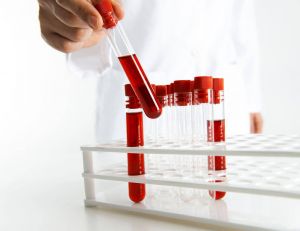 Dépistage de la trisomie 21 : un test sanguin arrive enfin / iStock.com - solidcolours