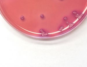 La bactérie NDM-1 a la particularité de résister à la plupart des antibiotiques disponibles sur le marché