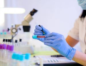 Santé : un test sanguin universel pour dépister le cancer ? / iStock.com - jovanmandic
