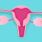 La première greffe d'utérus a eu lieu en France / iStock.com - Lin Shao-hua