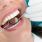 Soins dentaires : les Français ne vont pas assez chez le dentiste / iStock.com - oneblink-cj